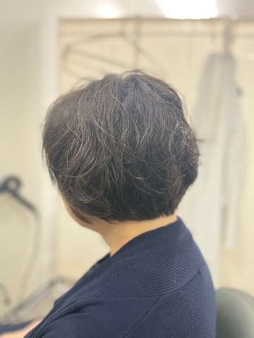 施術例